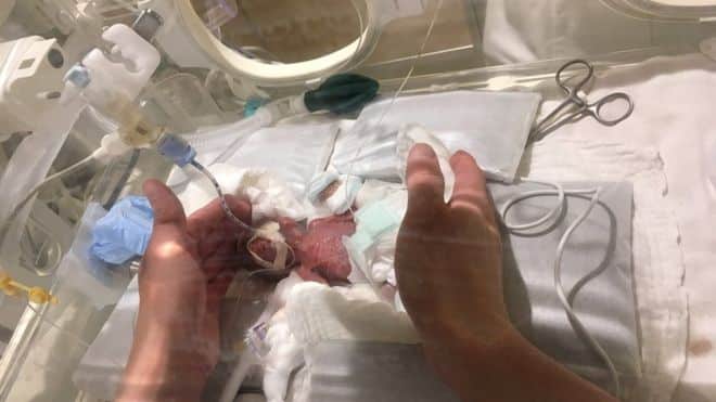 smert mladentsev v tunisskoi bolnitse kak pravyashhii rezhim stal serii nym ubii tsei